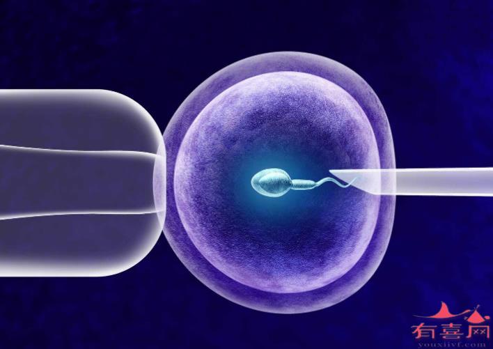 大连借卵试管助孕费用明细：第1代和第3代体外受精的区别是什么
