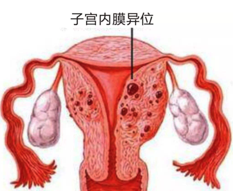胚胎停育是什么