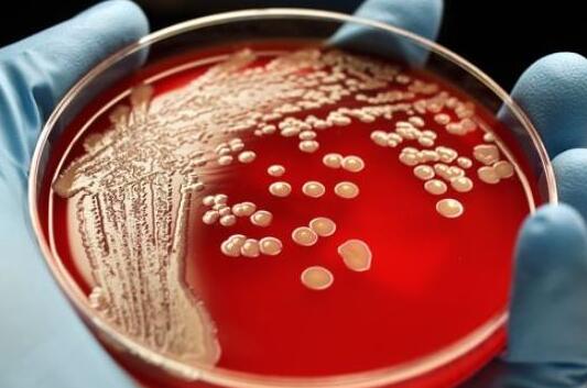 淋球菌检查是什么意思