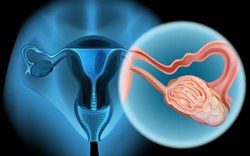 卵巢癌会遗传吗