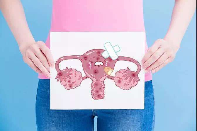 卵巢癌需要切除子宫吗