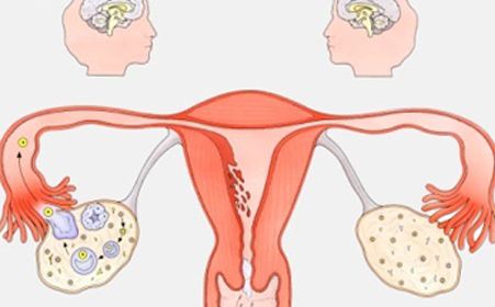 子宫炎症会变成子宫癌吗