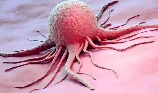 输卵管肿瘤是癌症吗