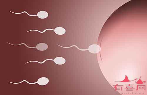 多囊卵巢综合症做泰国试管婴儿成功率高如何
