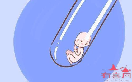 马来西亚试管婴儿能做几次
