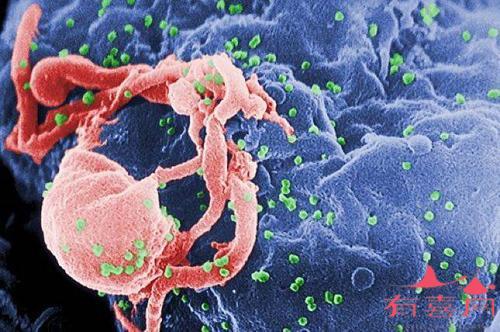 艾滋病是传染病吗