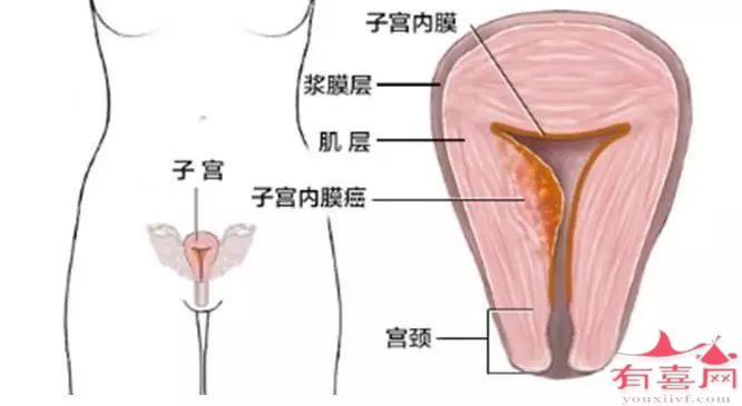 子宫内膜厚度7mm可以移植胚胎吗，怀孕成功率高吗