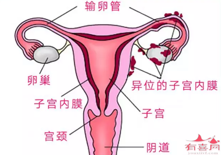 子宫内膜厚度15mm可以移植胚胎吗，怀孕成功率高吗
