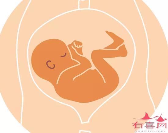 横位的胎心位置示意图图片