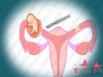 输卵管造影的副作用有哪些