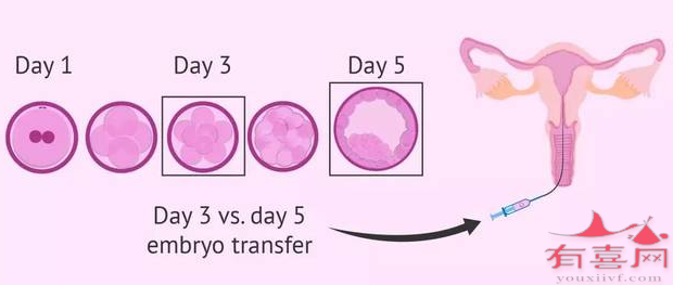 试管胚胎移植：移植囊胚一次多少钱