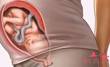 胎儿入盆是什么感觉，有什么症状