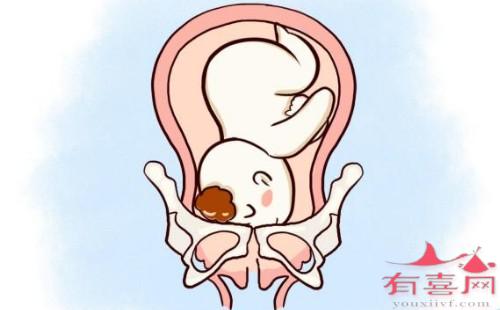 胎儿入盆走路有什么感觉