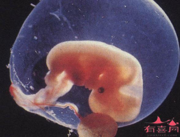 有褐色血说明胚胎已经生化吗