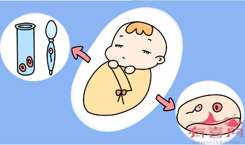 三代试管婴儿在胚胎移植前可进行基因筛查
