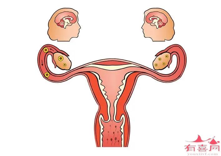 输卵管结核的症状有哪些，该如何预防