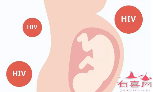 hiv患者如何才能生一个健康宝宝