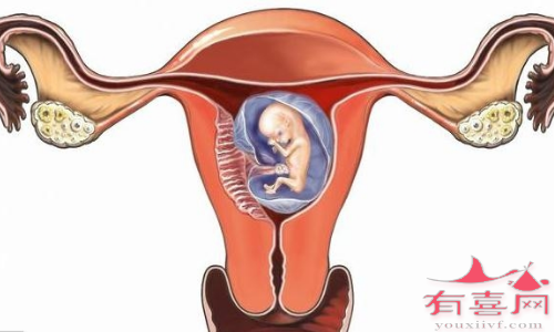 有卵巢早衰试管能成功吗