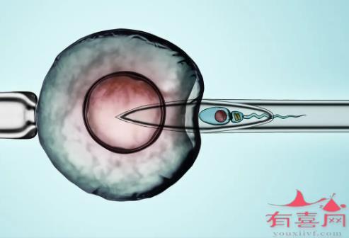 卵巢早衰试管婴儿成功率有多少