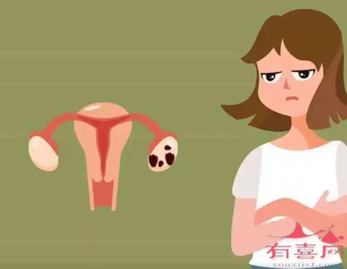 子宫局限性腺肌症严重吗